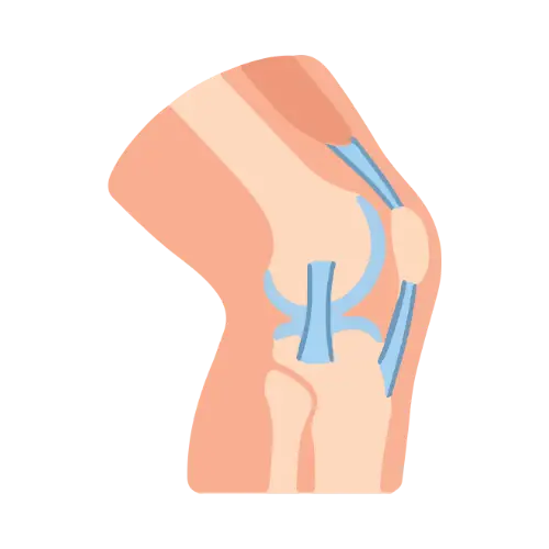 Condromalacia